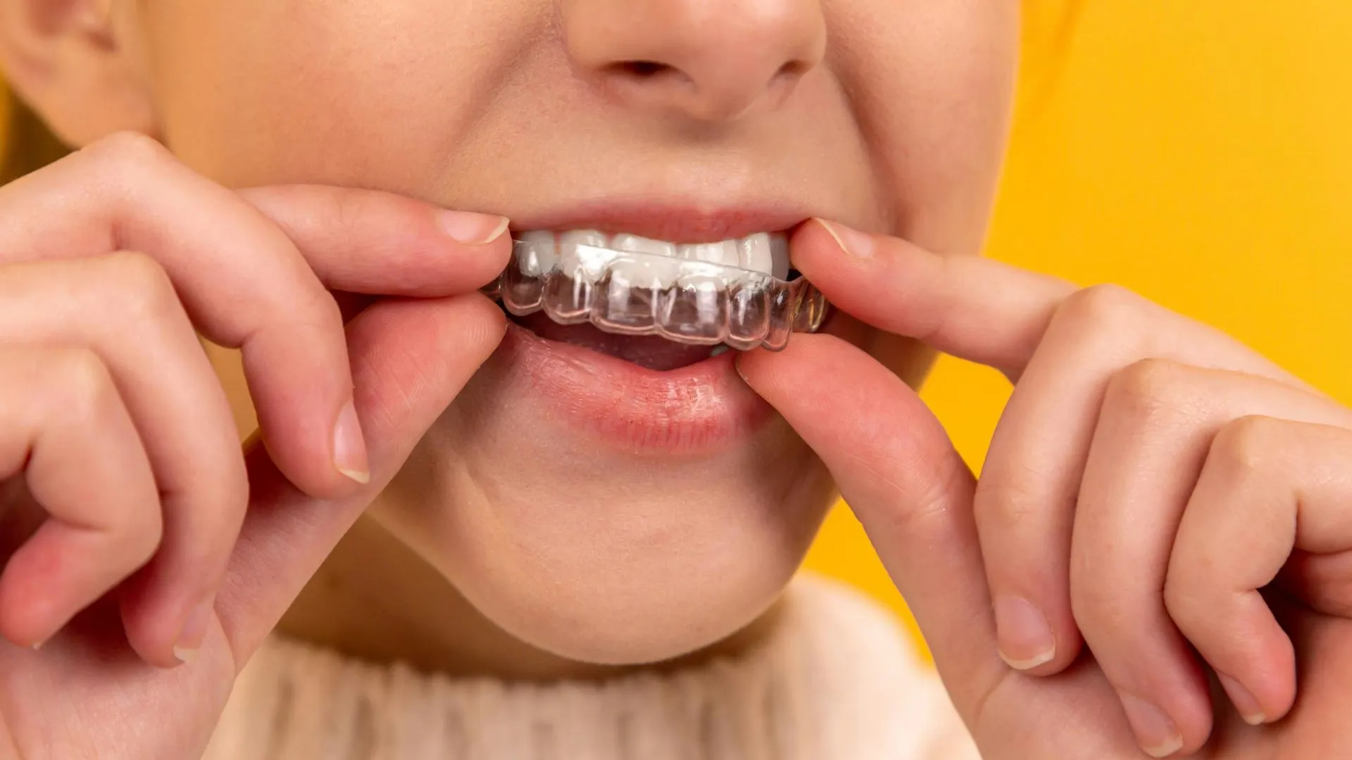 Детский стоматолог высказалась об использовании коронок на молочных зубах