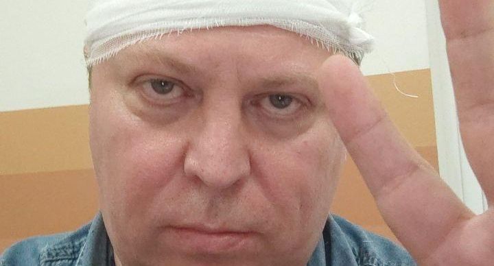 В Самаре мигранты избили депутата Госдумы Матвеева
