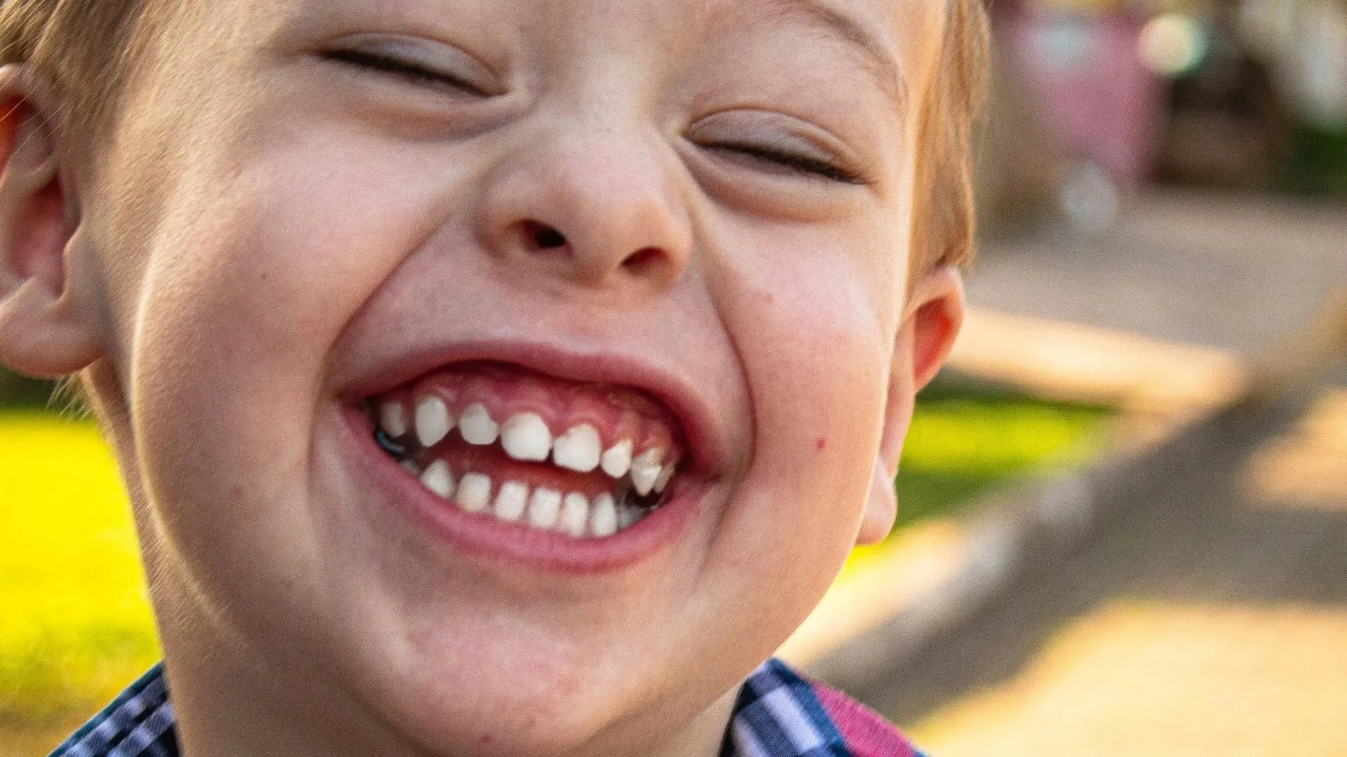 Анестезиолог рассказала о лечении детских зубов под наркозом