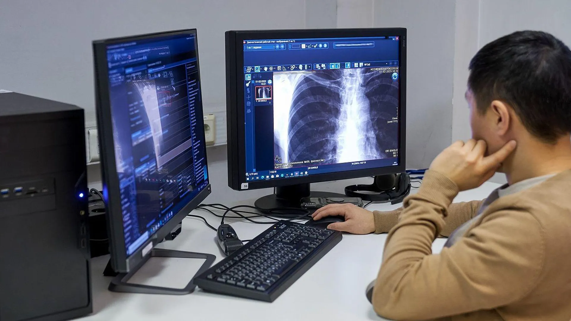 В поликлиниках Москвы ИИ начнет анализировать рентгеновские снимки