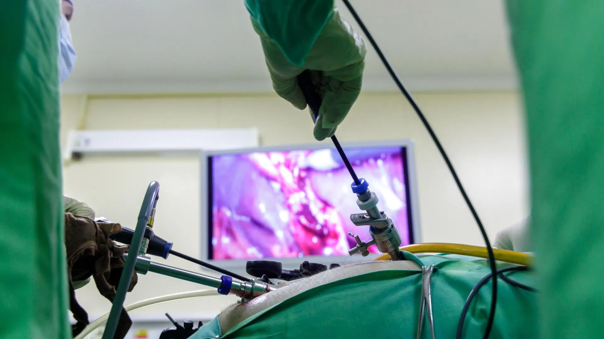В стационаре № 3 округа Люберцы в три раза выросло число хирургических операций